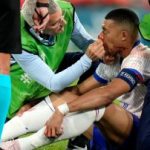 Máscara especial para Mbappé podría usarla para el próximo encuentro de la selección de Francia que será este viernes ante Países Bajos el jugador no será  operado de su nariz y estaría listo para para su proximo